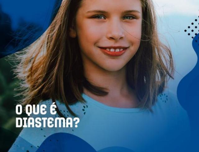 O que é Diastema